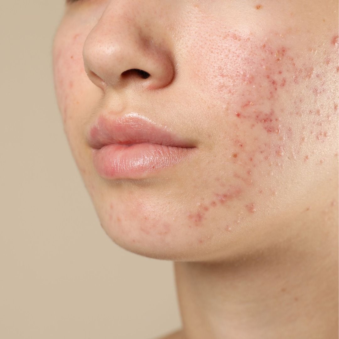 fc071201c8f71d0a8bf8fc669aa082df